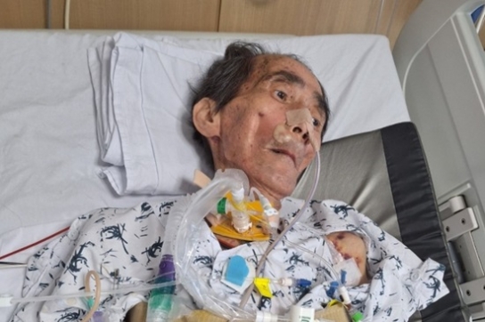 “기적을 선물한 간이식, 새로운 삶을 꿈꾸다”